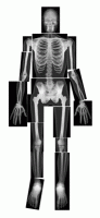 True-to-Life Human X-Rays [R5911]